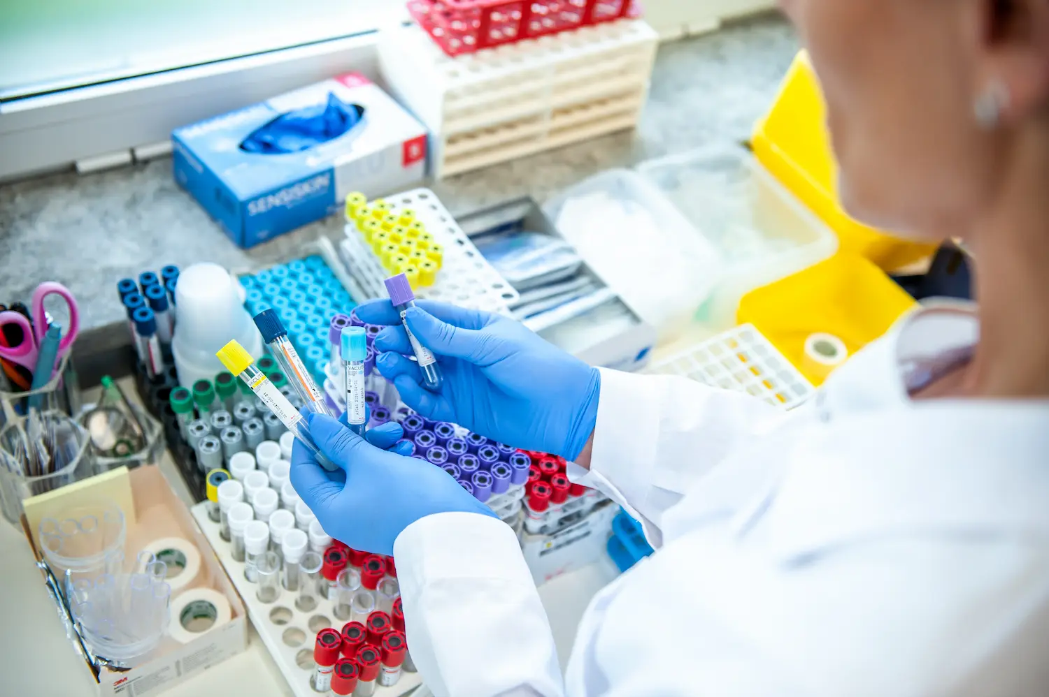Analisi autoimmunità ricerca anticorpi - MaGiKa Salute Samarate