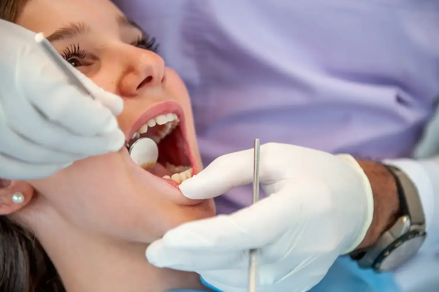 Estetica dentale sorriso perfetto - MaGiKa Salute Samarate